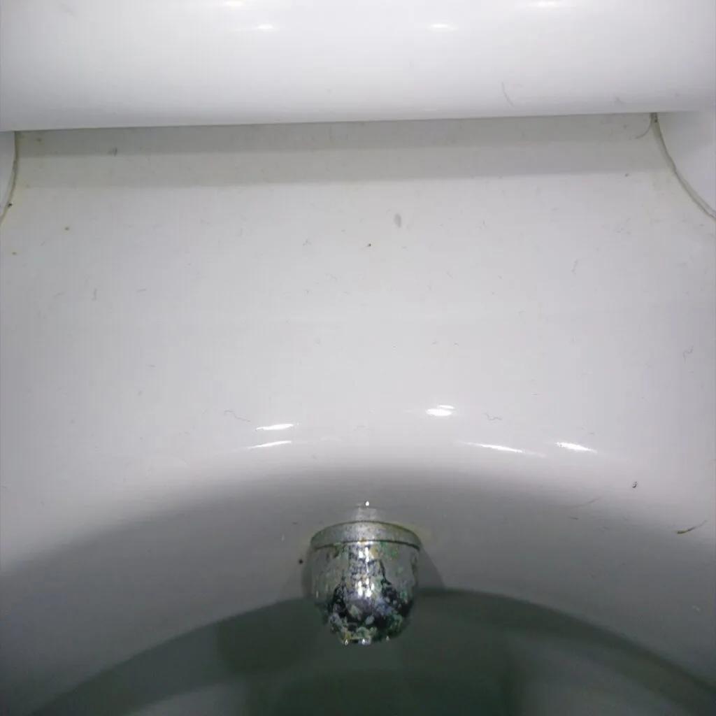 Urine