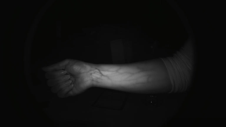 VASKÜLARİZASYON_ safe ultra system