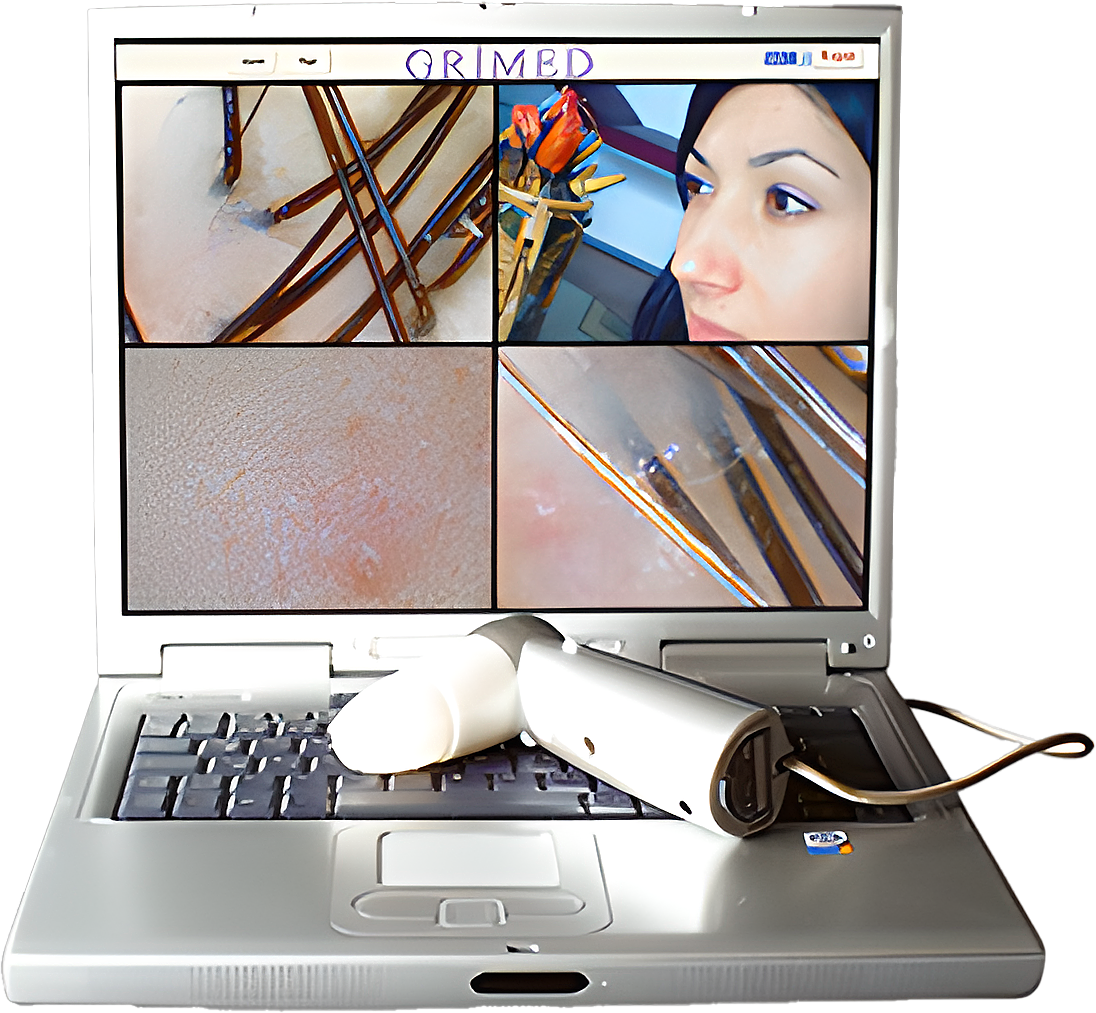 The World's First Computurized Skin & Hair Analysis Devices V.1 - ForenScope