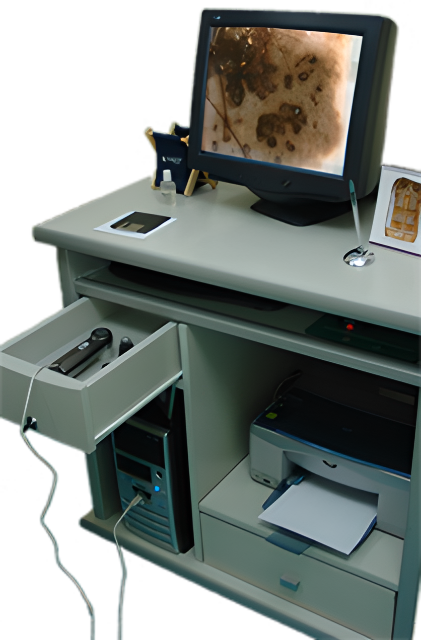 Computurized skin cancer detection devices video dermatoscope v.1 - ForenScope