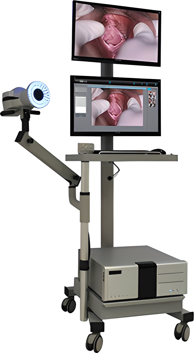 The world's first forensic medical polarized multispectral colposcope v.2 system - ForenScope