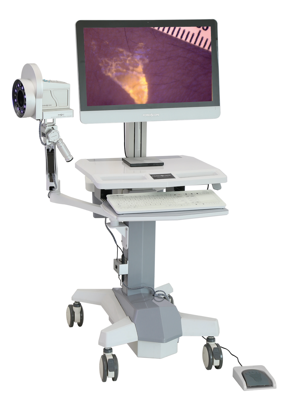 The World's First Full Automatic Forensic Medical Polarized Multispectral Colposcope V.1 System