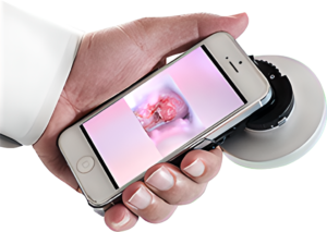 The World's First Mobile Multispectral Smartphone Colcoscope V.1 - forenscope