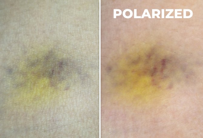 Polarize Süperspektral Görüntüleme