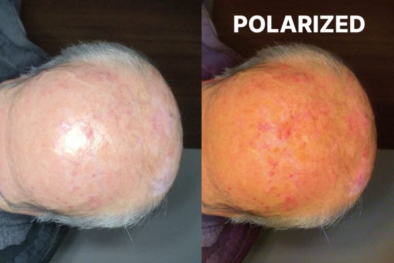 polarized-en