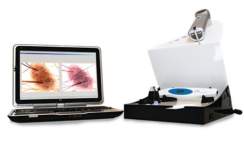 computerized skin and hair analysis devices V.2