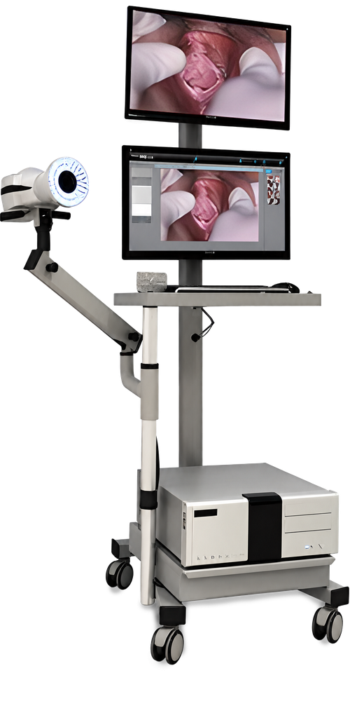 The World's First 18 MP Forensic Medical Polarized Colposcope System V.2