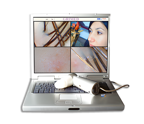 World's First USB-Connected Computerized Hair and Skin Analysis Devices v.1