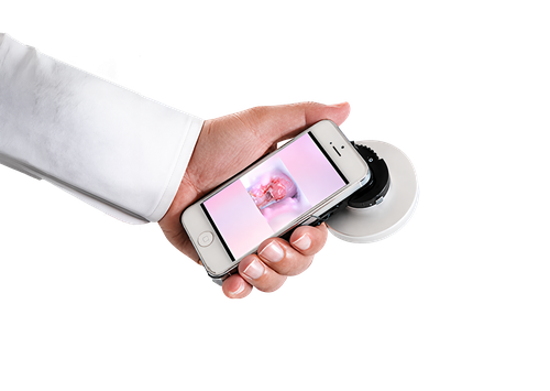 The World's First Mobile Multispectral Smartphone Colposcope V.1