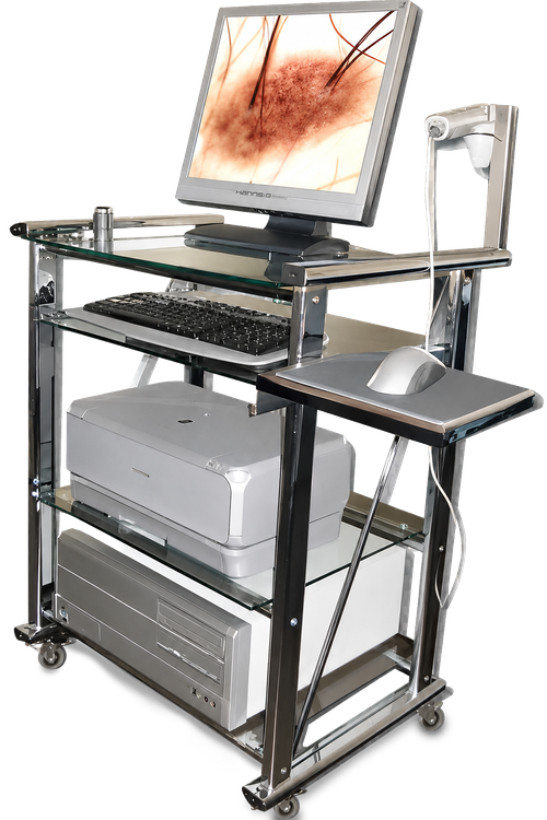 computerized skin cancer detection devices; video dermatoscope v.2