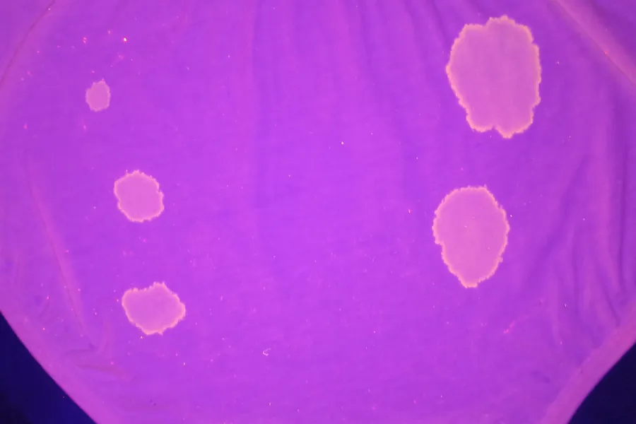 urine revealing combination with superspectral core